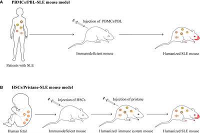 Humanized Mouse Models of Systemic Lupus Erythematosus: Opportunities and Challenges